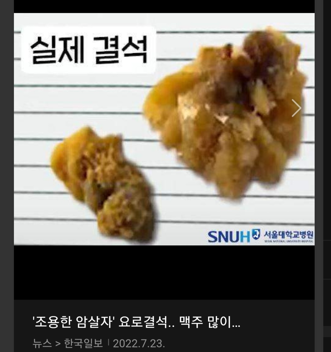 이거 요로결석같지않냐?
