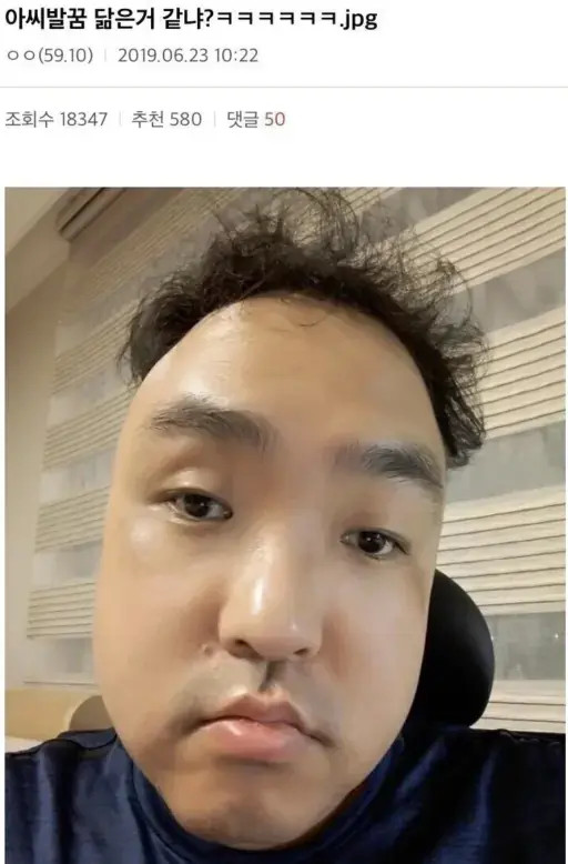 싱글벙글 디씨의 얼굴형 레전드.jpg