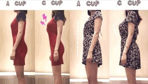 자연 AA컵 vs 수술한 C컵.jpg